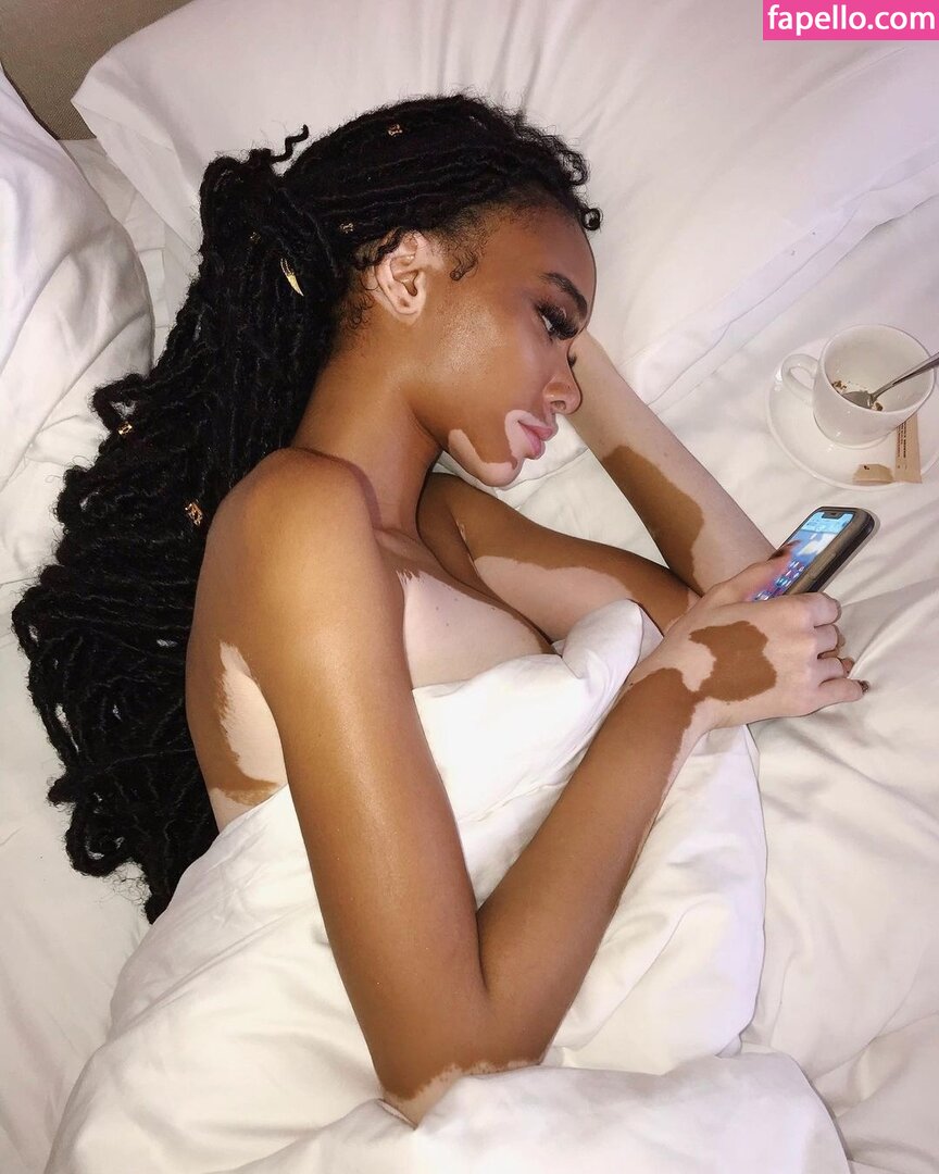 Winnie Harlow #10